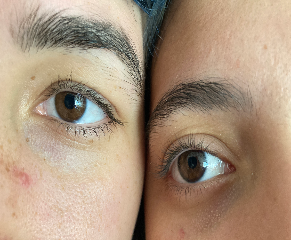 Eyes Close Together